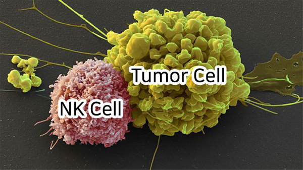 What is an NK Cell